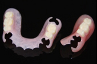 ノンクラスプ義歯